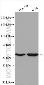 GAC Antibody in Western Blot (WB)