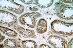 ITPR1 Antibody in Immunohistochemistry (Paraffin) (IHC (P))