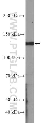 KCNB1 Antibody in Western Blot (WB)