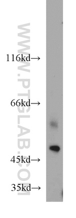 Kir2.1 Antibody in Western Blot (WB)