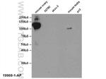 LHCGR Antibody in Western Blot (WB)