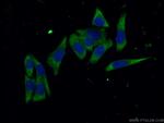MAP3K1 Antibody in Immunocytochemistry (ICC/IF)