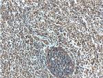 MAP3K1 Antibody in Immunohistochemistry (Paraffin) (IHC (P))