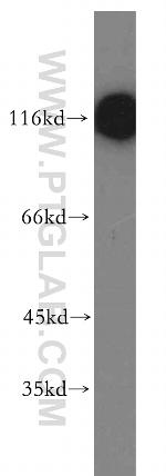 MLK2 Antibody in Western Blot (WB)