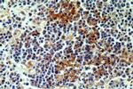 NKTR Antibody in Immunohistochemistry (Paraffin) (IHC (P))