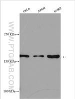 NKTR Antibody in Western Blot (WB)