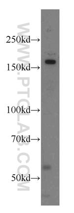 NKTR Antibody in Western Blot (WB)