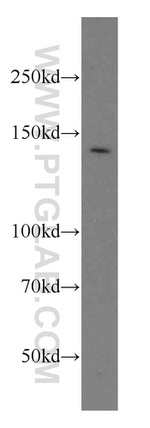 NKTR Antibody in Western Blot (WB)