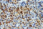 PAK2 Antibody in Immunohistochemistry (Paraffin) (IHC (P))
