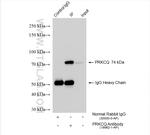 PRKCQ Antibody in Immunoprecipitation (IP)