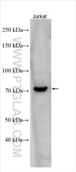 PRKCQ Antibody in Western Blot (WB)