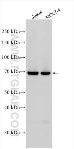 PRKCQ Antibody in Western Blot (WB)