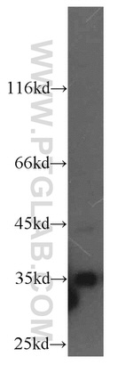 LDHB Antibody in Western Blot (WB)