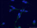 HBA1 Antibody in Immunocytochemistry (ICC/IF)