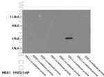 HBG1 Antibody in Western Blot (WB)
