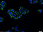 TGF-beta 2 Antibody in Immunocytochemistry (ICC/IF)
