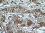 TGF-beta 2 Antibody in Immunohistochemistry (Paraffin) (IHC (P))
