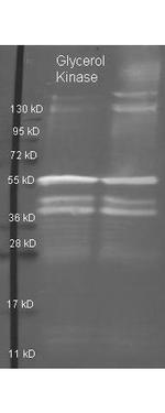 Glycerol Kinase Polyclonal Antibody