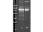 Maltose Phosphorylase Polyclonal Antibody