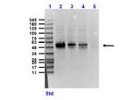 Sucrose Phosphorylase Polyclonal Antibody