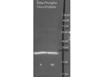 beta-Phosphoglucomutase Polyclonal Antibody