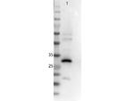 RFP Polyclonal Antibody