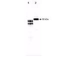 Fetuin Polyclonal Antibody