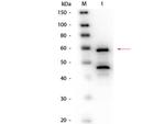 Bilirubin Oxidase Polyclonal Antibody, Biotin
