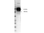 Pyruvate Kinase Antibody in Western Blot (WB)