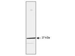 HSP27 Monoclonal Antibody (G3.1)