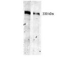 Thyroglobulin Monoclonal Antibody (2H11)