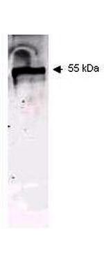 Keratin Antibody in Western Blot (WB)