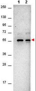 AKT Monoclonal Antibody (14E5.16C8.25F6)