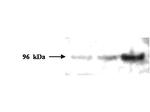 PMS2 Monoclonal Antibody (1204)