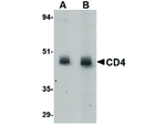 CD4 Monoclonal Antibody (8G1B12)