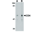 CD4 Monoclonal Antibody (9H5A8)