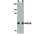 IRAK Antibody in Western Blot (WB)