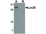 LIN28 Monoclonal Antibody (1G9H9)