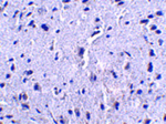 PD-1 Antibody in Immunohistochemistry (Paraffin) (IHC (P))