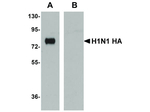 Seasonal H1N1 Hemagglutinin Monoclonal Antibody (7H12F6)