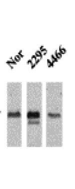CaMKII Antibody in Western Blot (WB)