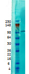 CASK Antibody in Western Blot (WB)