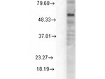 GABA-A Receptor delta Monoclonal Antibody (N151/3)