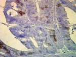 Hsp70/Hsc70 Antibody in Immunohistochemistry (Paraffin) (IHC (P))
