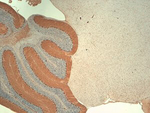 IP3 Receptor Antibody in Immunohistochemistry (IHC)