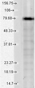 KCNQ1 Antibody in Western Blot (WB)