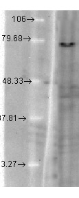 KCNQ1 Antibody in Western Blot (WB)