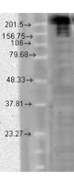 NAV1.7 Antibody in Western Blot (WB)