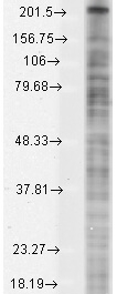 Nav1.8 Antibody in Western Blot (WB)