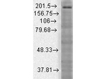 SHANK3 Monoclonal Antibody (S69)
